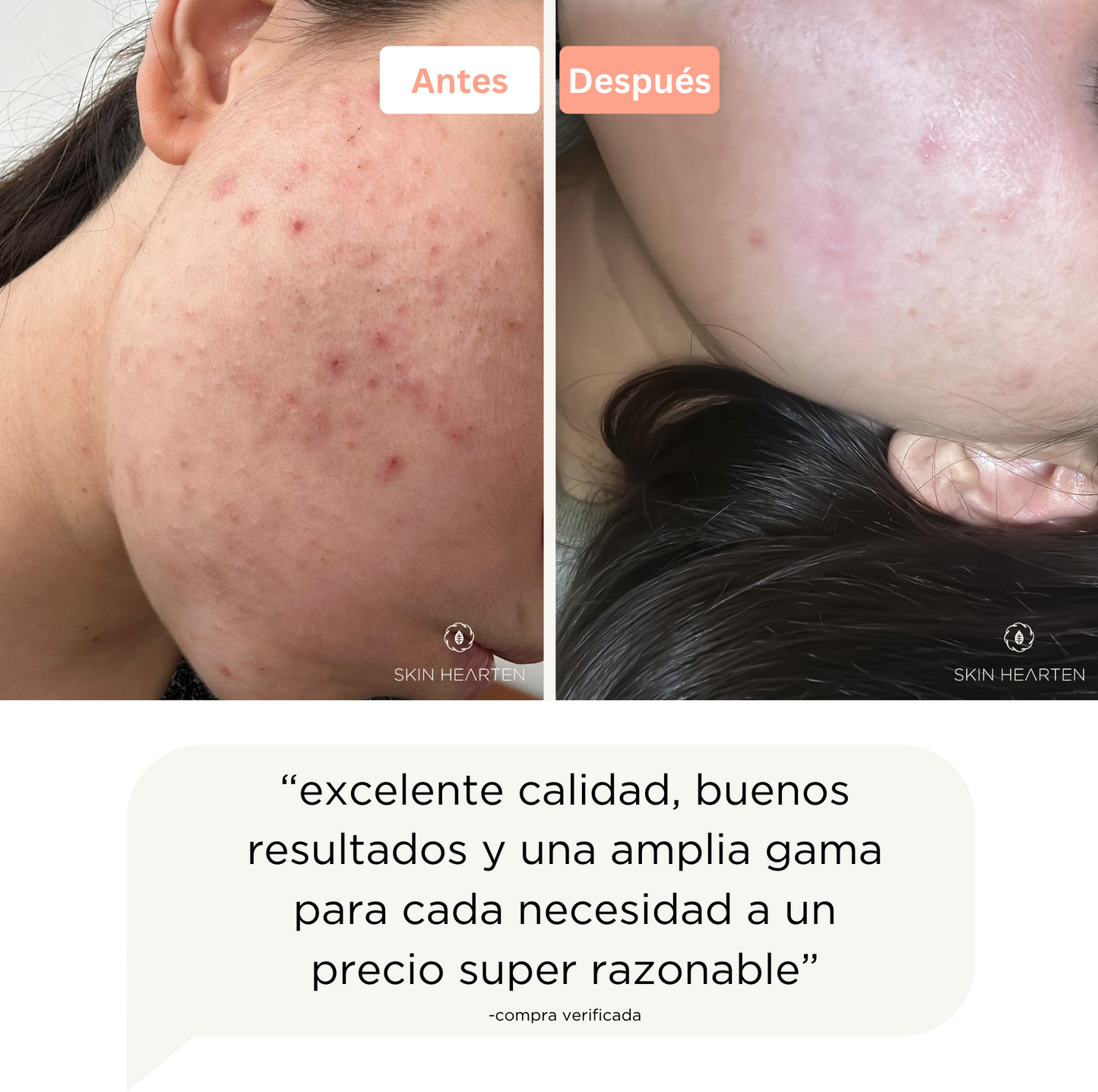 Crema Aclarante